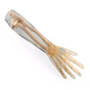 Low arm Phantom